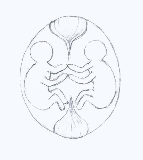Twin in mother's womb
